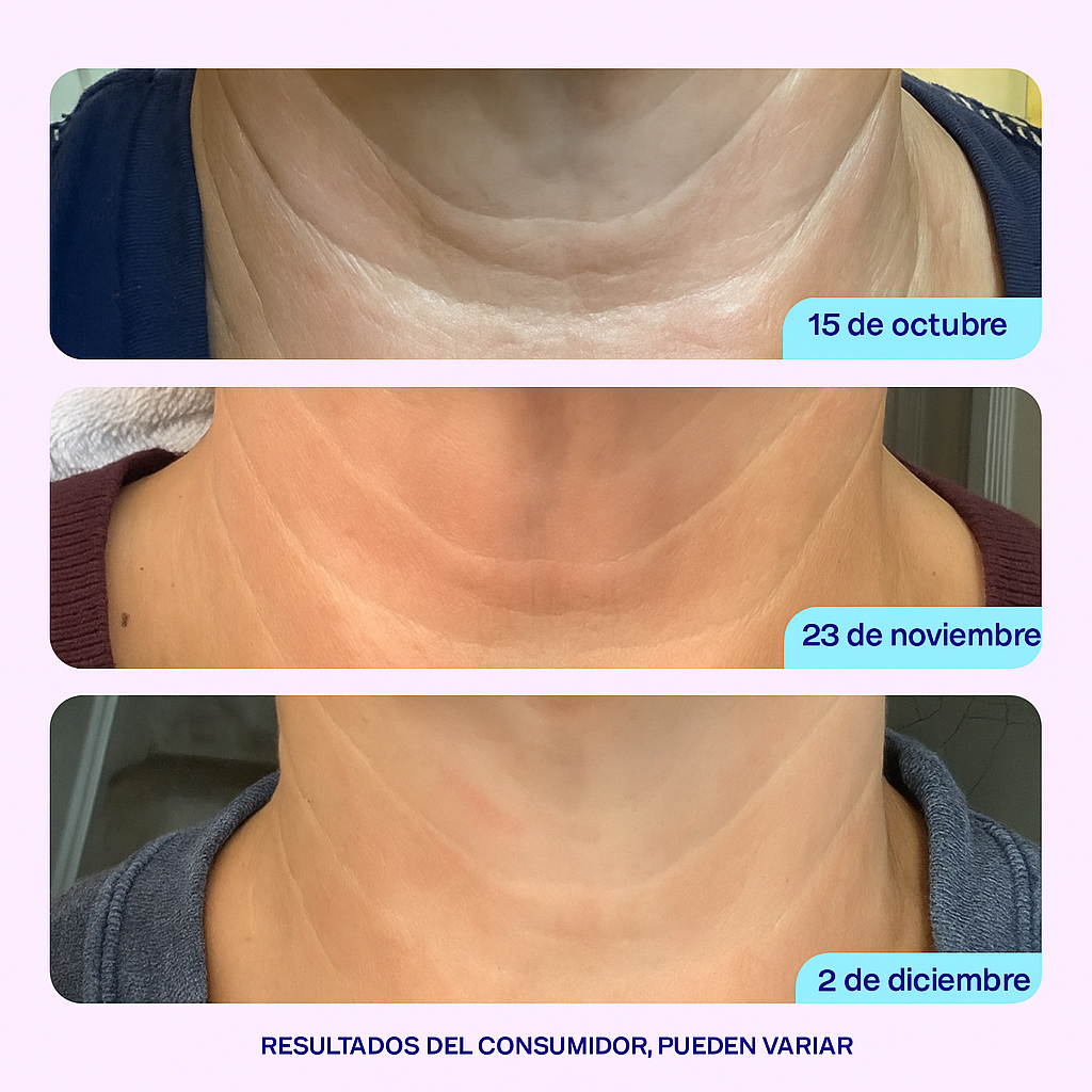 Firméa™ - Crema Reafirmante y Lifting para el Cuello