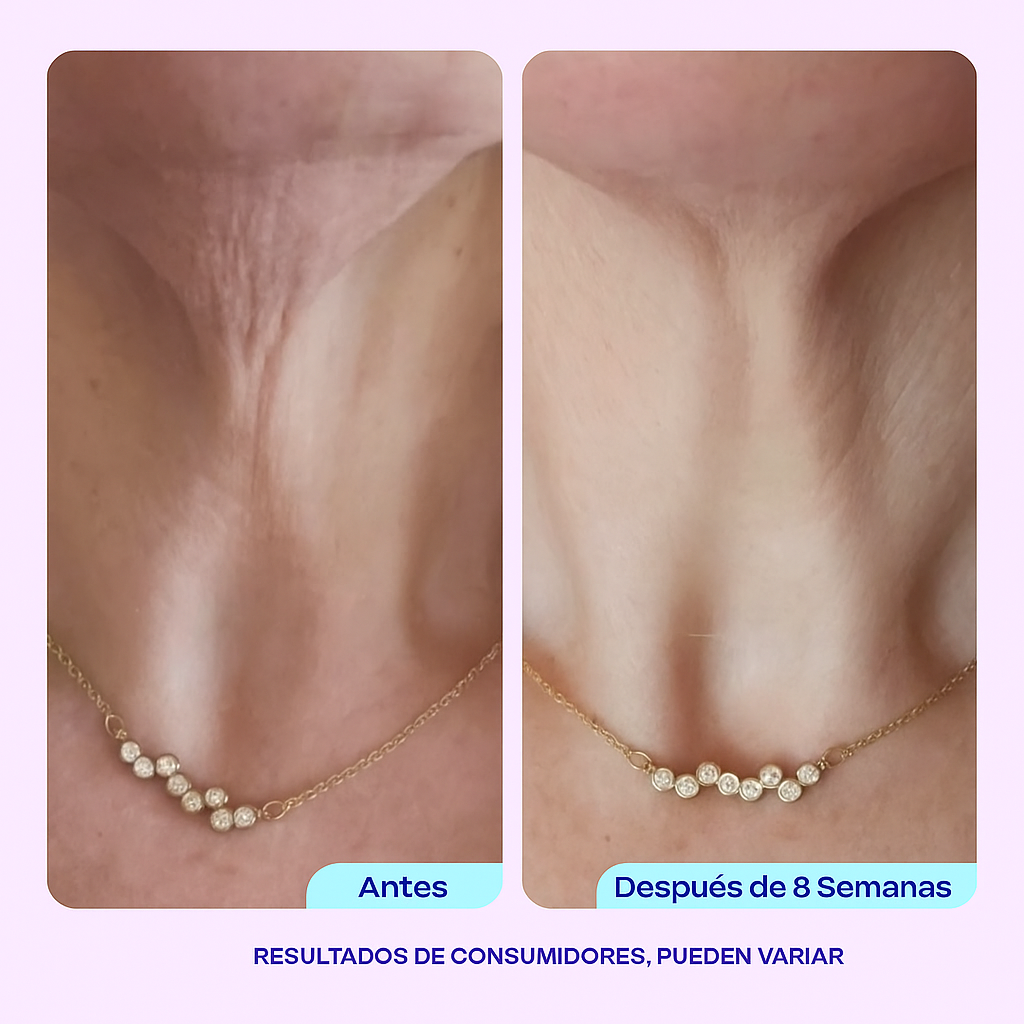 Firméa™ - Crema Reafirmante y Lifting para el Cuello